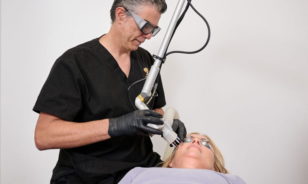 Laser resurfacing Perth DOT Co2 fractional