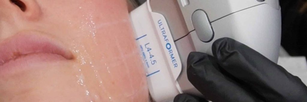 HIFU Perth skin tightening firming