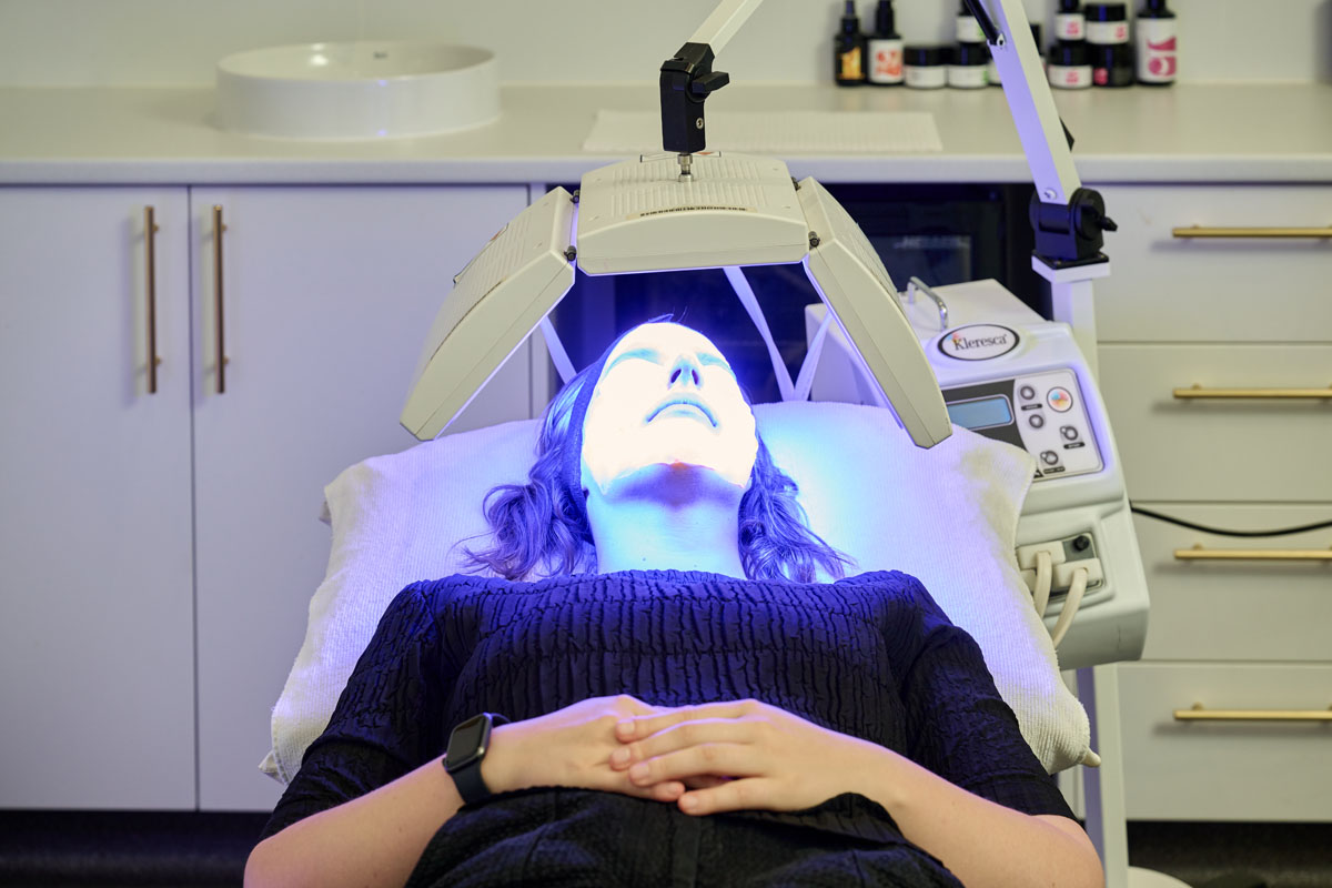 Laser Treatment for Acne and Scarring Perth