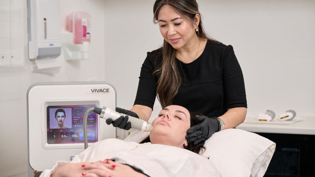 Vivace RF Microneedling Skin Treatment Perth Near Me