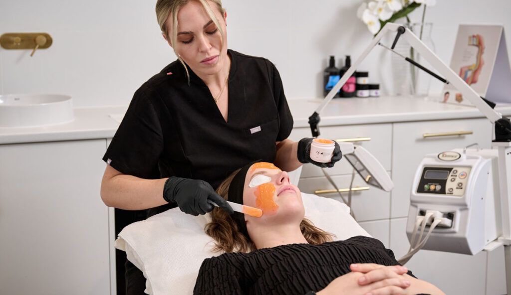 Acne scar treatment acne breakout treatment Perth